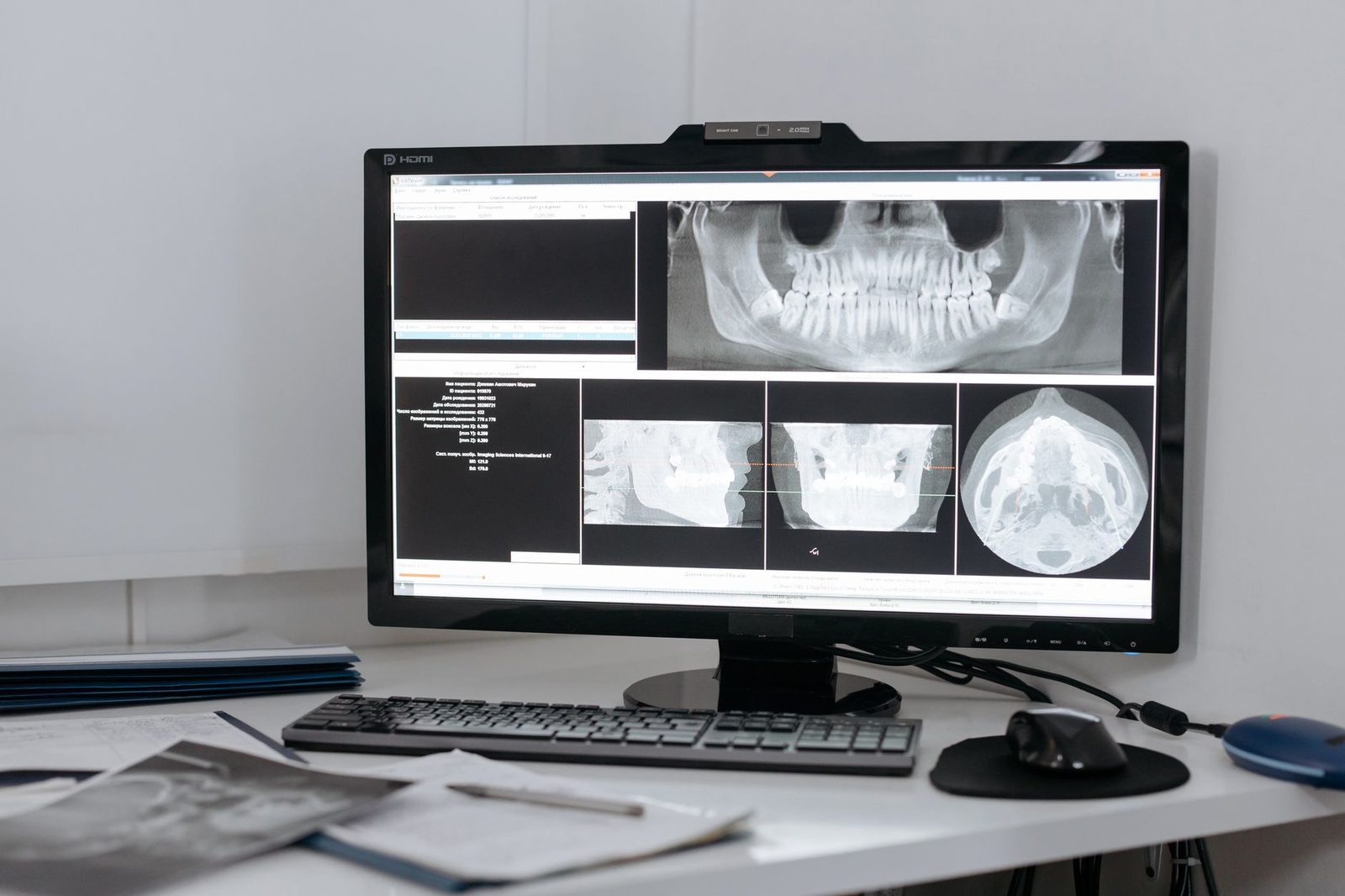 Medical X-ray images displayed on a clinic monitor